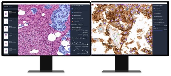 Online demo image of Lunit SCOPE