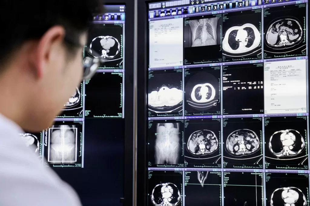 Doctor at a hospital in Lishui city of Chinas Zhejiang province examines a CT scan